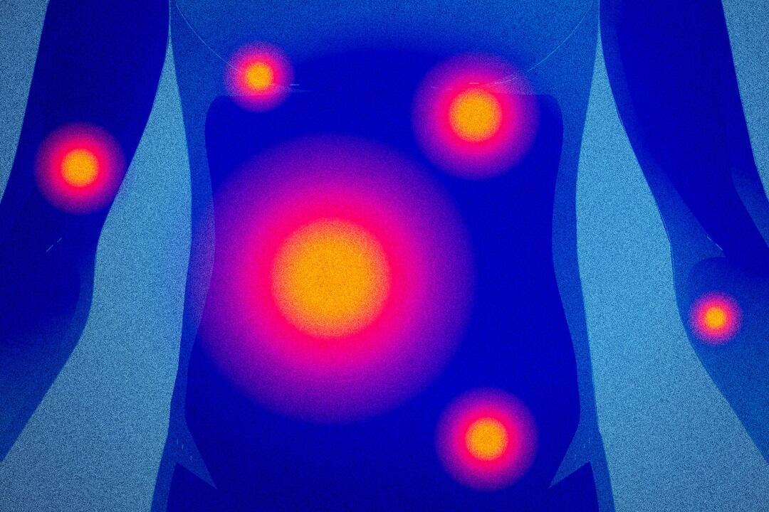 Inflammation is the "Fire Within". Kure it calms the fire of inflammation.