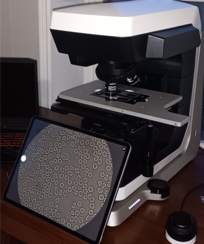 Microscope for live blood analysis of Kure it Bible Healing oils.