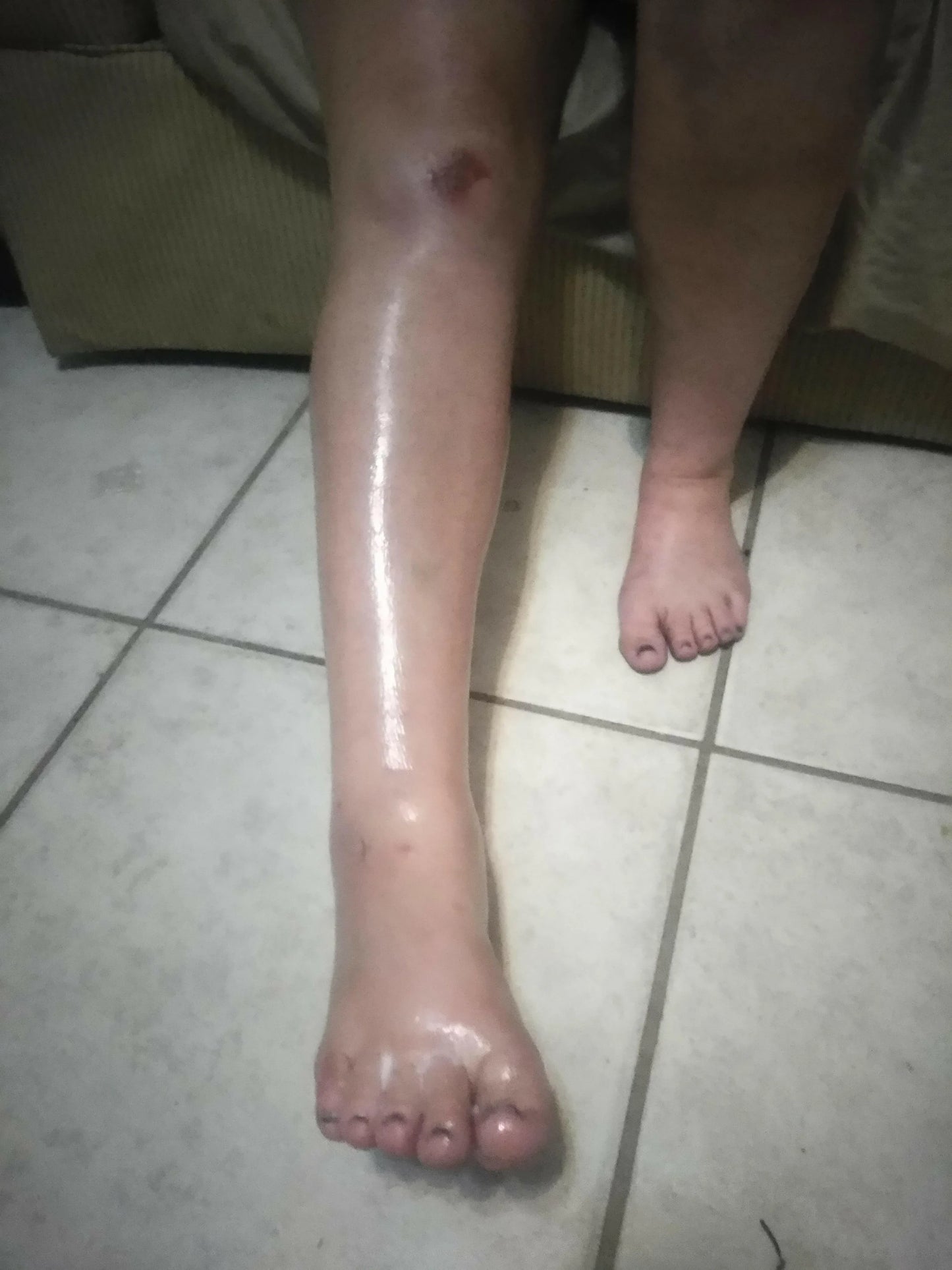 Kure it Rx Bible anointing oil for sprains and pains.