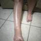 Sprained ankle healed using Good Samaritan Oil.