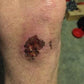 Knee injury helped by using Good Samaritan healing oil