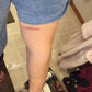 Leg burn day 2, pain free healing with Good Samaritan oil