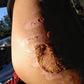 day 3 shoulder burn helped by a good samaritan oil