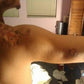 Fast Wound Healing with Kure it Biblical Healing Oil.