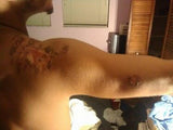 Fast Wound Healing with Kure it Biblical Healing Oil.