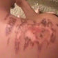 Week 2 3rd degree burns healed using Good Samaritan healing oil.